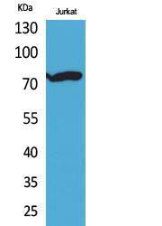 Anti-p73 Delta N Rabbit Polyclonal Antibody