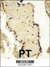 Anti-SPPL2A Rabbit Polyclonal Antibody