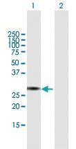 Anti-TRIM72 Mouse Polyclonal Antibody