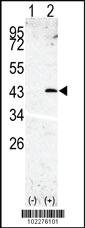 Anti-SPPL3 Rabbit Polyclonal Antibody