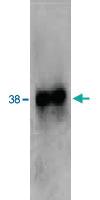 Anti-FPR2 Rabbit Polyclonal Antibody