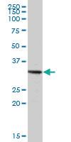 Anti-TRIM72 Mouse Polyclonal Antibody