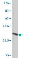 Anti-AADAC Mouse Polyclonal Antibody