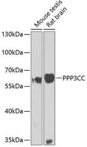 Western blot analysis of extracts of various cell lines, using Anti-PPP3CC Antibody (A10209) at 1:1,000 dilution