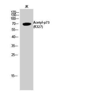 Anti-p73 Delta N Rabbit Polyclonal Antibody