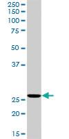 Anti-RNH1 Rabbit Polyclonal Antibody