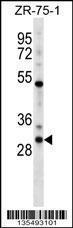 Anti-HOXD1 Rabbit Polyclonal Antibody (AP (Alkaline Phosphatase))