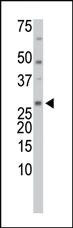 Anti-TXNL1 Rabbit Polyclonal Antibody