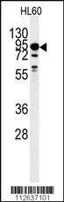 Anti-DYRK1A Rabbit Polyclonal Antibody