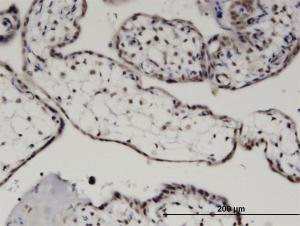 Anti-KAT6A Mouse Monoclonal Antibody [clone: 4D8]