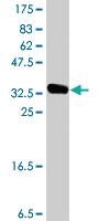 Anti-RNF146 Mouse Polyclonal Antibody