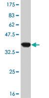 Anti-MAPKAPK2 Mouse Monoclonal Antibody [clone: 2B3]