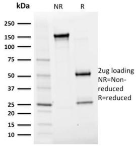 SDS-PAGE analysis of Anti-Albu min Antibody [ALB/2356] under non-reduced and reduced conditions; showing intact IgG and intact heavy and light chains, respectively. SDS-PAGE analysis confirms the integrity and purity of the Antibody