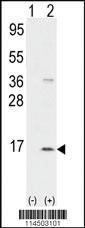 Anti-ACTR6 Rabbit Polyclonal Antibody