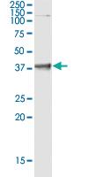 Anti-POU6F1 Polyclonal Antibody Pair