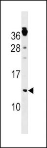 Anti-CKS1B Rabbit Polyclonal Antibody (HRP (Horseradish Peroxidase))