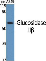 Anti-GLU2B antibody