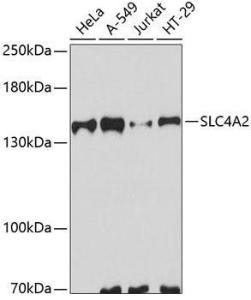 Western blot analysis of extracts of various cell lines, using Anti-AE2 Antibody (A10212) at 1:3,000 dilution. The secondary antibody was Goat Anti-Rabbit IgG H&L Antibody (HRP) at 1:10,000 dilution.