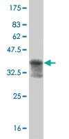 Anti-MAPKAPK2 Mouse Monoclonal Antibody [clone: 1F9]