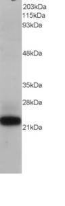 EB05058 staining (0.1µg/ml) of Jurkat lysate (RIPA buffer, 1.4E+05 cells per lane). Primary incubated for 12 hour. Detected by western blot using chemiluminescence.