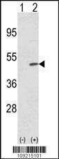 Anti-TRIB2 Rabbit Polyclonal Antibody (APC (Allophycocyanin))