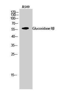 Anti-GLU2B antibody