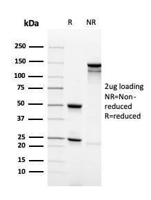 SDS-PAGE analysis of Anti-Synaptophysin Antibody [rSYP/4654] under non-reduced and reduced conditions; showing intact IgG and intact heavy and light chains, respectively. SDS-PAGE analysis confirms the integrity and purity of the antibody