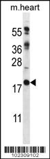 Anti-RCAN2 Rabbit Polyclonal Antibody