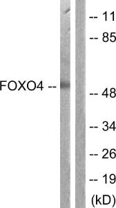 Western blot analysis of lysates from K562 cells using Anti-FOXO4 Antibody. The right hand lane represents a negative control, where the antibody is blocked by the immunising peptide