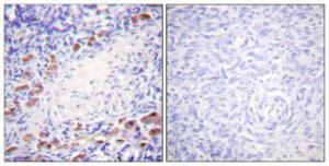 Antibody anti-DAXX 100 µg