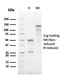 SDS-PAGE analysis of Anti-ATG5 Antibody [AGT5/3220R] under non-reduced and reduced conditions; showing intact IgG and intact heavy and light chains, respectively. SDS-PAGE analysis confirms the integrity and purity of the antibody