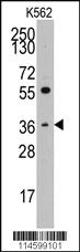 Anti-THPO Rabbit Polyclonal Antibody