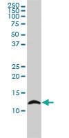 Anti-LY6H Mouse Monoclonal Antibody [clone: 3E10]