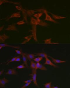 Immunofluorescence analysis of C6 cells using Anti-STAT5 Antibody (A10213) at a dilution of 1:50 (40x lens). DAPI was used to stain the cell nuclei (blue).