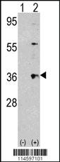 Anti-THPO Rabbit Polyclonal Antibody