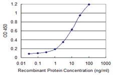 Anti-TRIM72 Mouse Monoclonal Antibody [clone: 3B5]