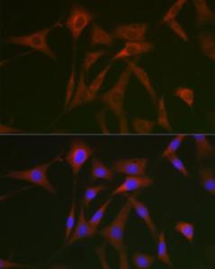 Immunofluorescence analysis of NIH/3T3 cells using Anti-STAT5 Antibody (A10213) at a dilution of 1:50 (40x lens). DAPI was used to stain the cell nuclei (blue).