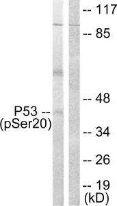 Western blot analysis of lysates from COS7 cells treated with UV 5' using Anti-p53 (phospho Ser20) Antibody. The right hand lane represents a negative control, where the Antibody is blocked by the immunising peptide