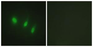 Immunofluorescence analysis of HeLa cells using Anti-FOXO4 Antibody. The right hand panel represents a negative control, where the antibody was pre-incubated with the immunising peptide