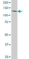 Anti-ERN1 Mouse Monoclonal Antibody [clone: 4D12]