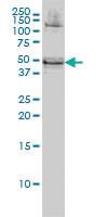 Anti-RBMS1 Mouse Monoclonal Antibody [clone: M1]