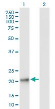 Anti-GPX8 Mouse Polyclonal Antibody