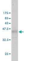 Anti-RASA3 Mouse Monoclonal Antibody [clone: 1F11]