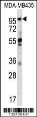 Anti-CTAGE5 Rabbit Polyclonal Antibody (AP (Alkaline Phosphatase))