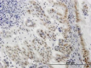 Anti-SGK1 Mouse Monoclonal Antibody [clone: 3C4]