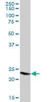 Anti-GPX8 Mouse Polyclonal Antibody