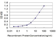 Anti-ERN1 Mouse Monoclonal Antibody [clone: 4D12]