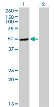 Anti-RNH1 Mouse Monoclonal Antibody [clone: 3F5]