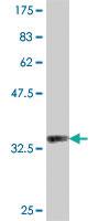 Anti-RNFT1 Mouse Polyclonal Antibody