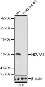 Western blot analysis of extracts from wild type(WT) and NDUFA4 knockout (KO) 293T(KO) cells, using Anti-NDUFA4 Antibody (A307518) at 1:1,000 dilution. The secondary antibody was Goat Anti-Rabbit IgG H&L Antibody (HRP) at 1:10,000 dilution.